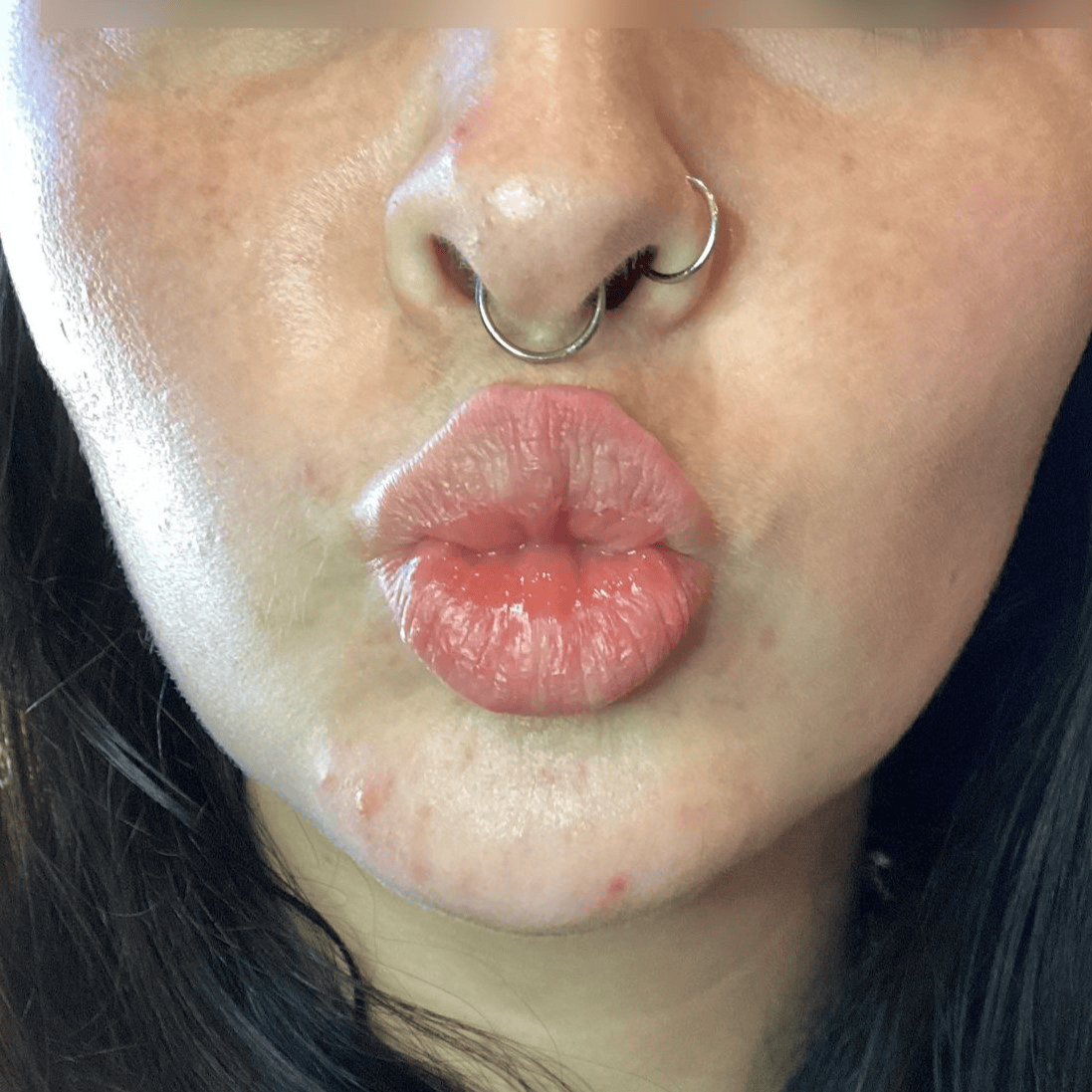 a close up of a woman's face with a nose ring Before and after lip filler