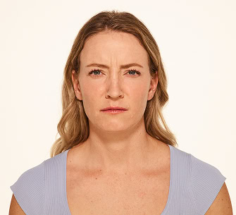 A woman with long blonde hair and a light purple top is looking straight ahead with a furrowed brow and slightly pursed lips, appearing serious or concerned—perfect for a Botox Landing visual against a plain light background.